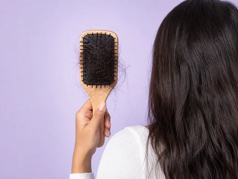 Cepillo con cabello caído entre las cerdas